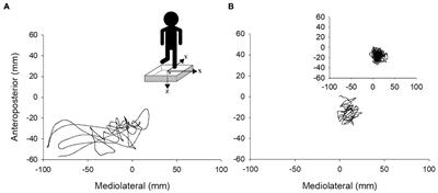 Intermuscular coherence of plantar and dorsiflexor muscles in older adults with Parkinson’s disease and age-matched controls during bipedal and unipedal stance